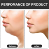 U Shape Jaw Exerciser New Facial Pop N Go Mouth Jawline Face Fitness Muscle Chew Ball Bite Breaker Training Equipment - Image 7